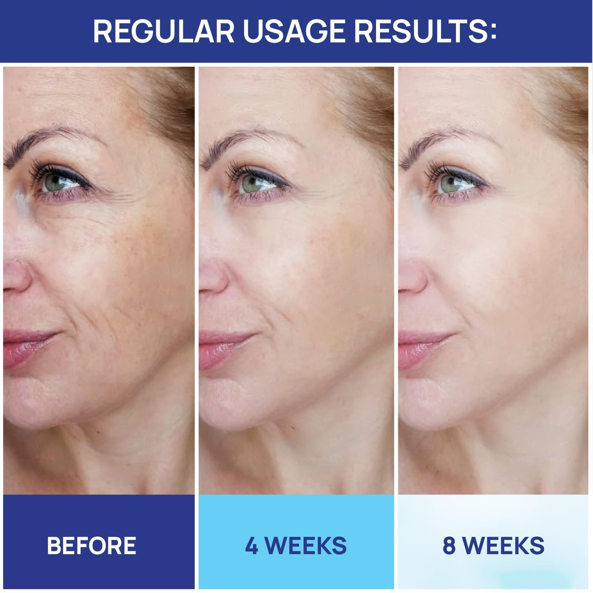 Retinol Cream for Face   Collagen and Retinol Moisturizer with Hyaluronic Acid Day Night Anti Aging Retinol Face Moisturizer for Women Men Collagen Cream for Face Reduces Wrinkles Dryness 1.85 Oz