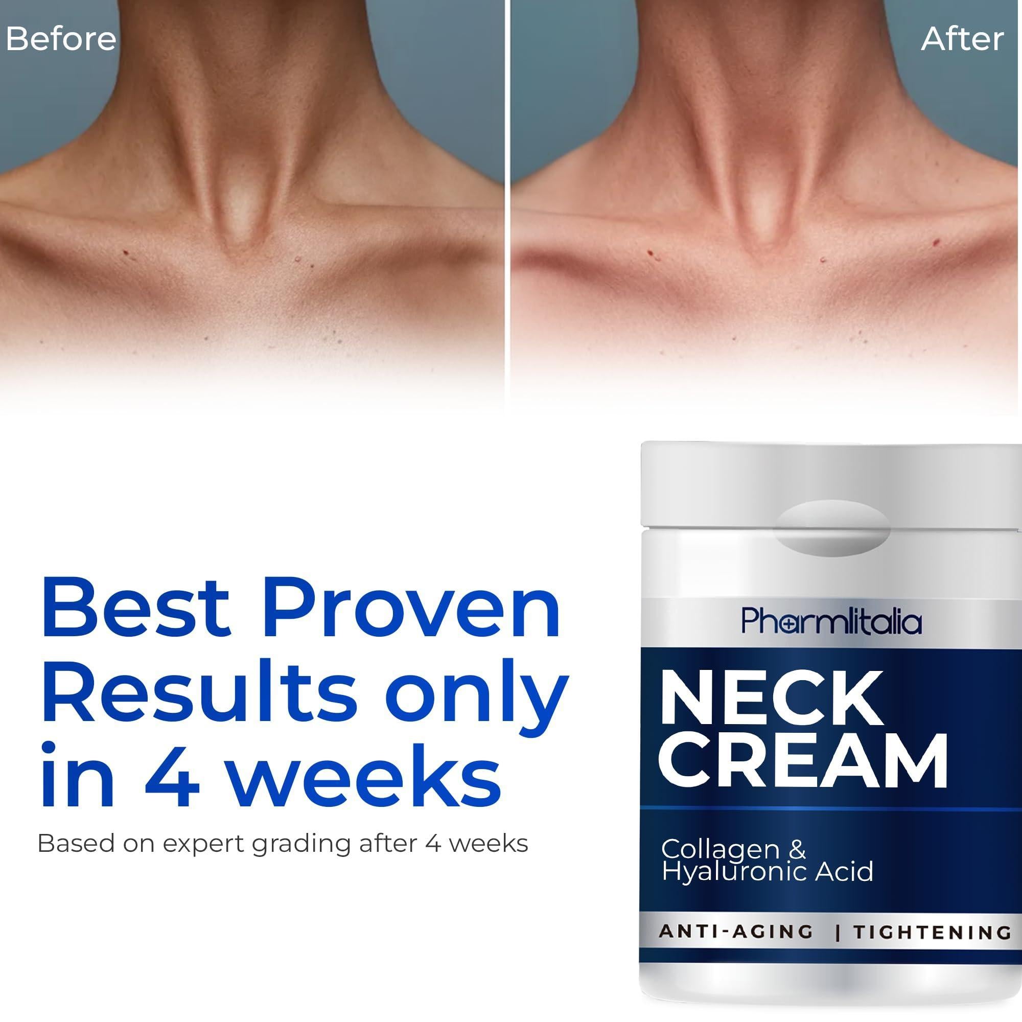 Neck Firming and Tightening Cream with Collagen & Hyaluronic Acid   Anti aging Neck Cream for Lifting and Wrinkles for an Even Skin Tone   Neck Firming Cream   Best for Tightening Sagging Skin