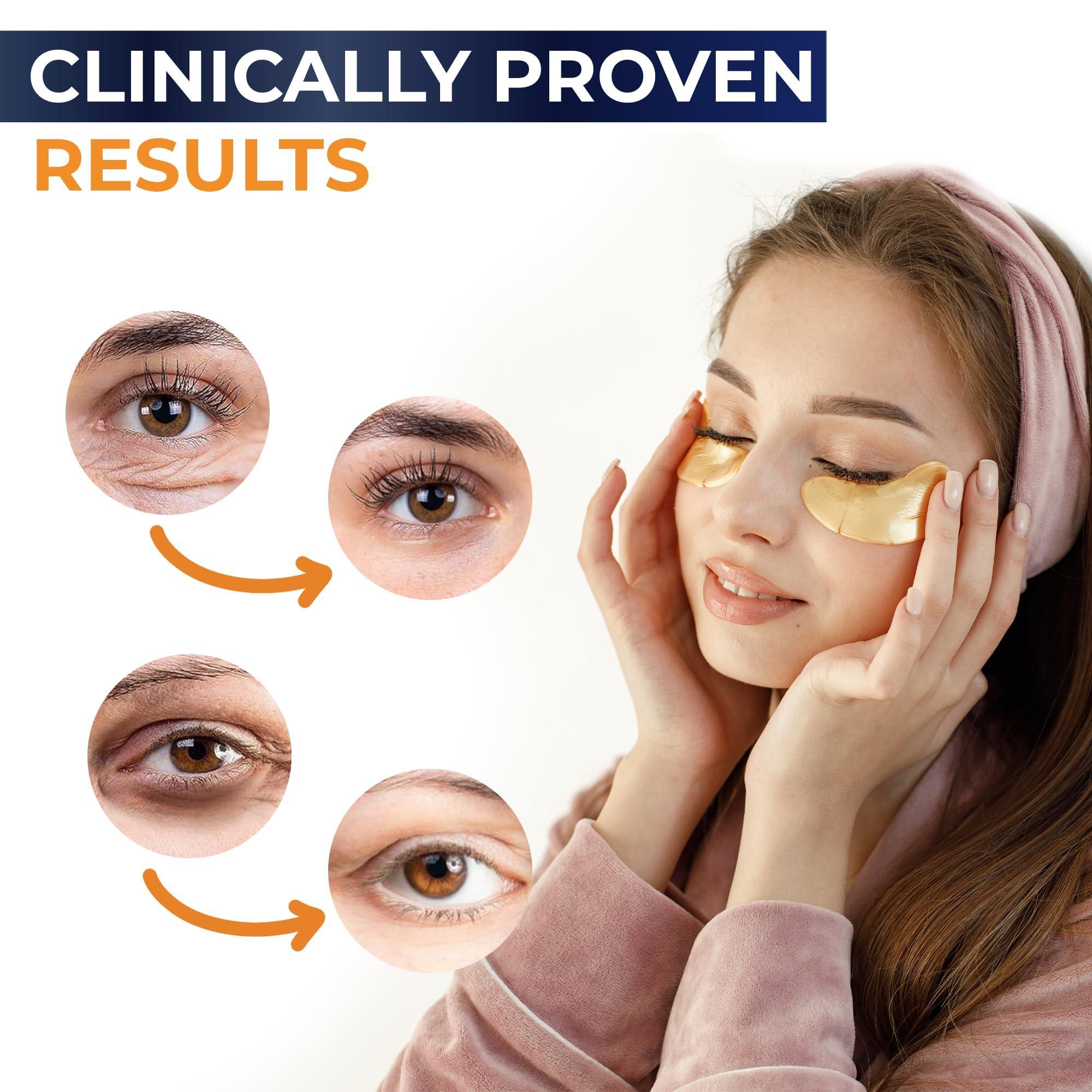 Under Eye Patches For Puffy Eyes And Dark Circles   30 Pair Eye Masks Anti Aging Collagen Hyaluronic Acid  Under Eye Mask for Removing Dark Circles Puffiness & Wrinkles Refresh Your Skin